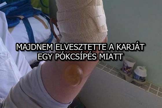 MAJDNEM-ELVESZTETTE-A-KARJA